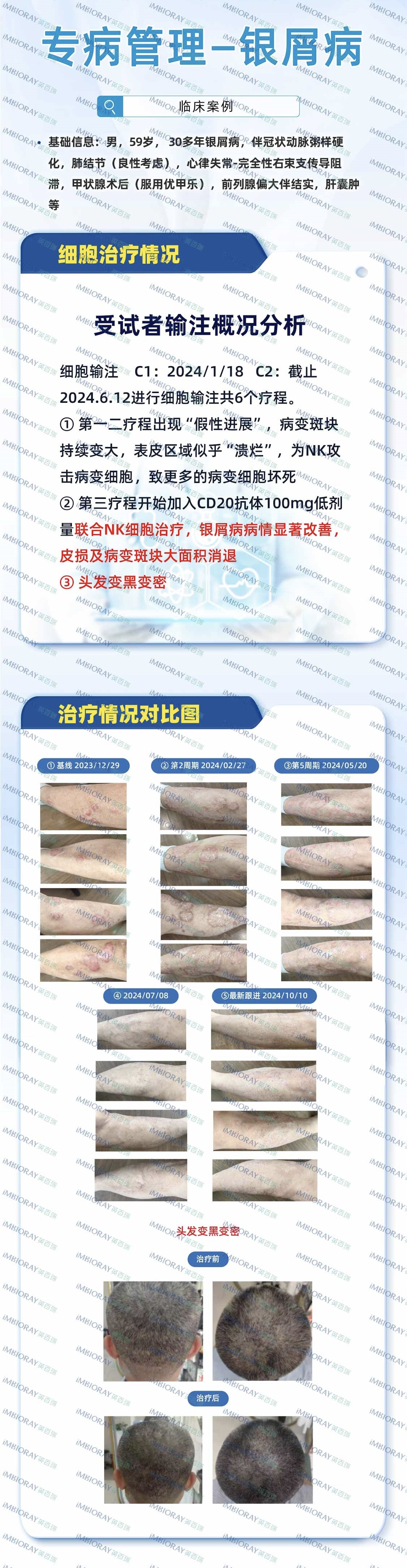癌症管理